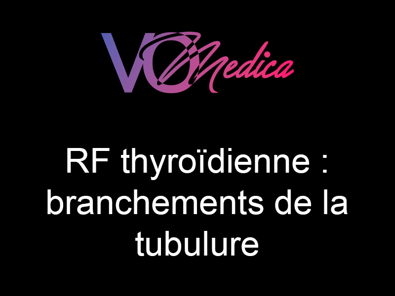 tubulure Radiofréquence thyroïdienne